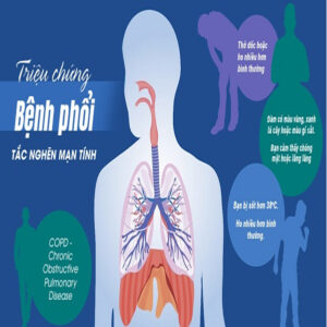 Bệnh-phổi-tắc-nghẽn-mãn-tính-các-bệnh-mắc-kèm-là-gì