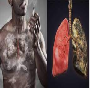 Các nguy cơ gây ung thư phổi
