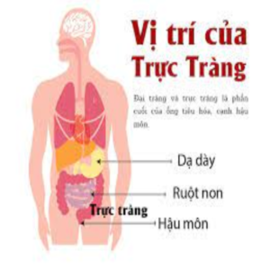 Dấu hiệu ung thư đường ruột