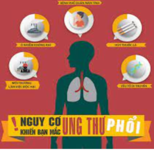 Những nguy cơ mắc ung thư phổi