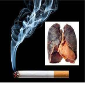 Nguy cơ Ung thư Phổi: Mối liên kết với Hút thuốc lá