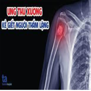 Dấu hiệu ung thư xương tay