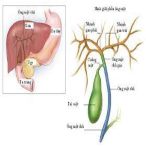 Ung thư đường mật