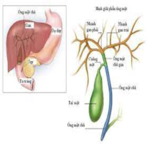 Ung thư đường mật trong gan