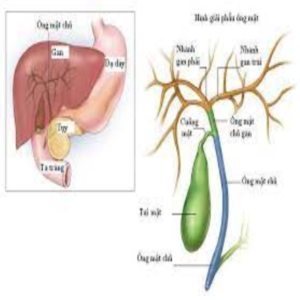 U đường mật trong gan