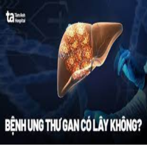 Ung thư gan có lây qua đường ăn uống không